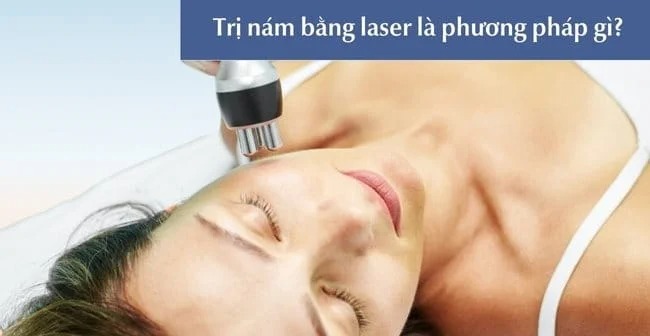 đốt nám bằng laser